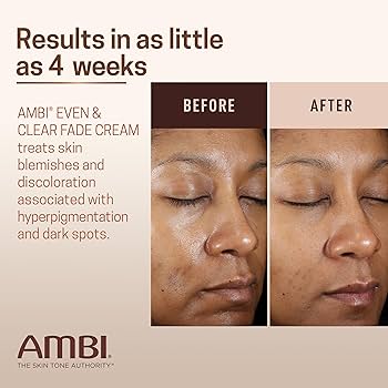 AMBI Even & Clear Fade Serum Retinol 1 Oz Pack of 1